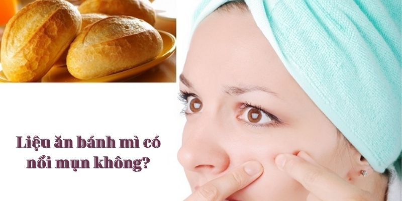 Liệu ăn bánh mì có nổi mụn không?